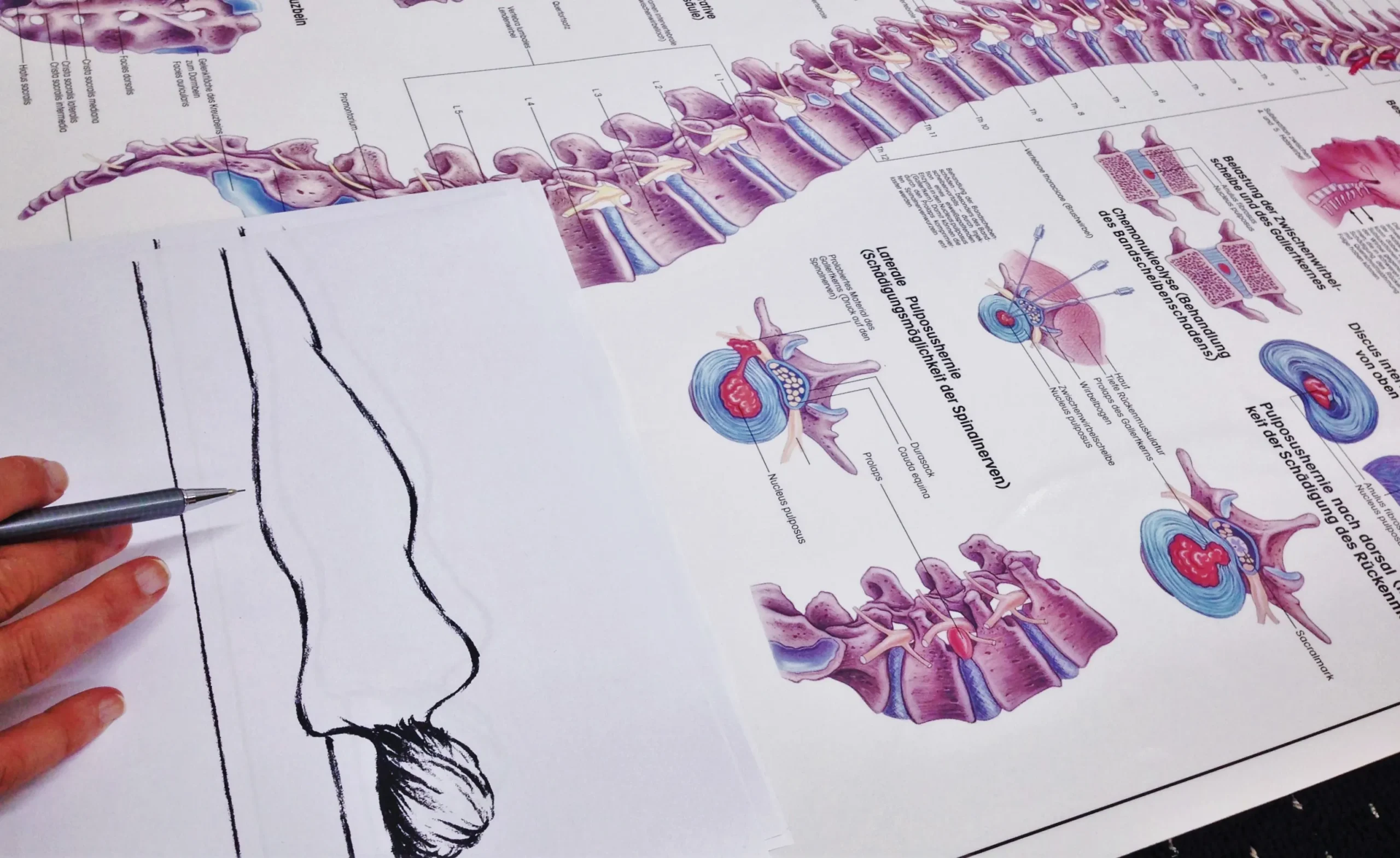 Rückenschmerzen – Matratzen, Kopfkissen und Lattenroste
