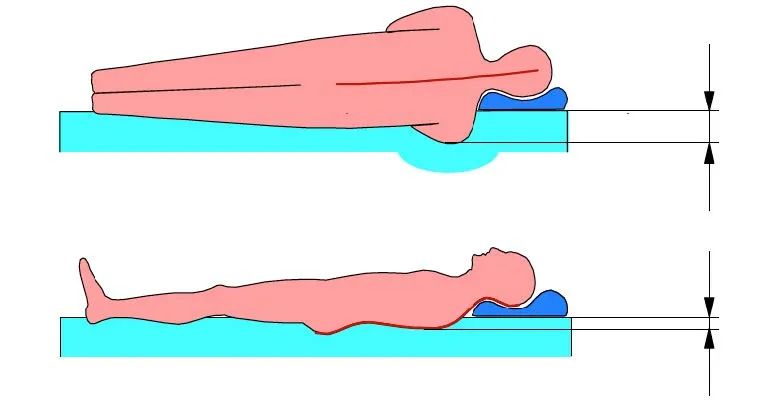 Seitenlage Schulterzone
